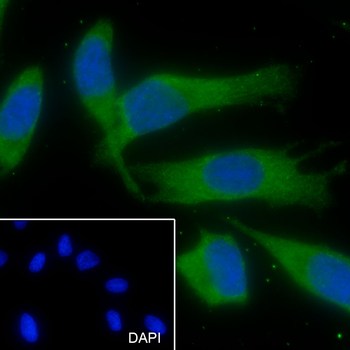TMEM111 Recombinant Mouse Monoclonal Antibody
