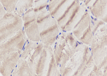 SLC9A9 Recombinant Mouse Monoclonal Antibody