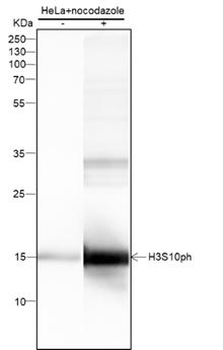 Phospho-Histone H3 (Ser10) Recombinant Mouse Monoclonal Antibody