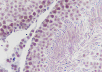 Phospho-Histone H3 (Ser10) Recombinant Mouse Monoclonal Antibody