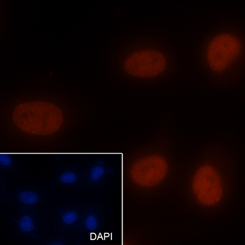 Acetyl-Histone H3 (Lys27) Mouse Monoclonal Antibody