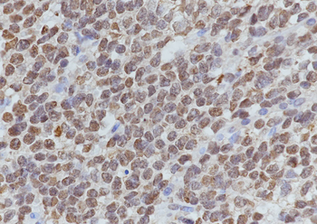 Acetyl-Histone H3 (Lys27) Mouse Monoclonal Antibody