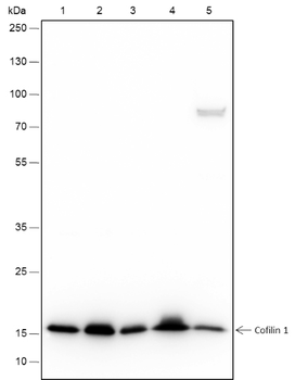 Cofilin 1 Recombinant Rabbit Monoclonal Antibody