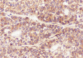 SEPT2 Recombinant Mouse Monoclonal Antibody