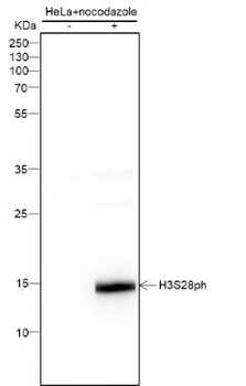 Phospho-Histone H3 (Ser28) Recombinant Mouse Monoclonal Antibody