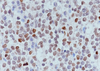 Histone H3 (tri methyl K9, phospho S10) Rabbit Polyclonal Antibody