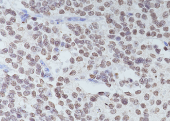 Di-Methyl-Histone H3 (Lys36) Mouse Monoclonal Antibody