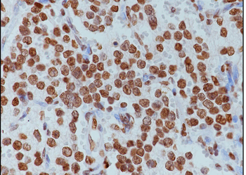 Mono-Methyl-Histone H3 (Lys79) Rabbit Polyclonal Antibody
