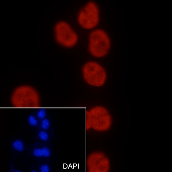 Tri-Methyl-Histone H3 (Lys36) Rabbit Polyclonal Antibody