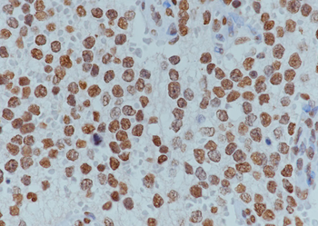 Tri-Methyl-Histone H3 (Lys36) Rabbit Polyclonal Antibody