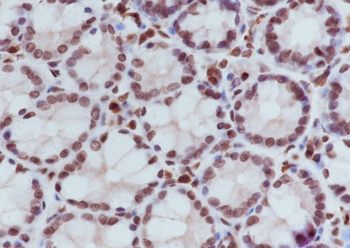 Tri-Methyl-Histone H3 (Lys36) Rabbit Polyclonal Antibody