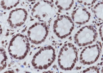 Tri-Methyl-Histone H3 (Lys4) Rabbit Polyclonal Antibody