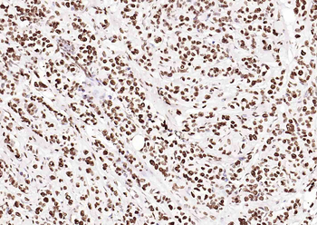 ERCC1 Recombinant Rabbit Monoclonal Antibody