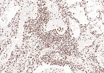 ERCC1 Recombinant Rabbit Monoclonal Antibody