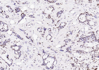 ERCC1 Recombinant Rabbit Monoclonal Antibody