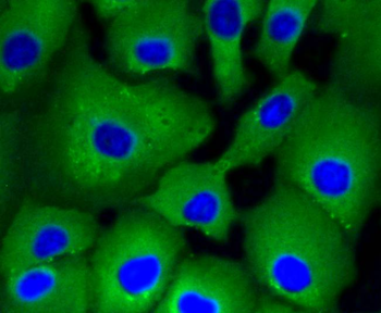 ACLY Recombinant Rabbit Monoclonal Antibody