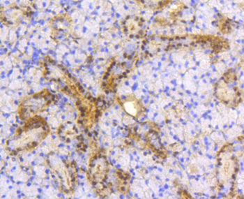 ACLY Recombinant Rabbit Monoclonal Antibody