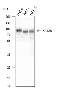 KAT2B Recombinant Rabbit Monoclonal Antibody