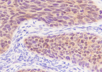 S100A2 Recombinant Rabbit Monoclonal Antibody