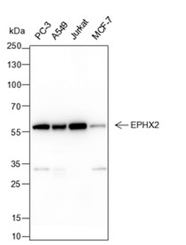 EPHX2 Recombinant Mouse Monoclonal Antibody