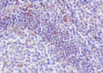 VISTA Recombinant Rabbit Monoclonal Antibody