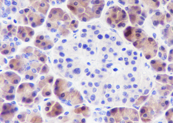 SPINK1 Recombinant Rabbit Monoclonal Antibody