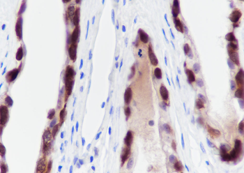 CTAG1B Recombinant Rabbit Monoclonal Antibody