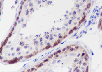 CTAG1B Recombinant Rabbit Monoclonal Antibody