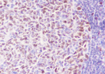 MCM3 Recombinant Rabbit Monoclonal Antibody