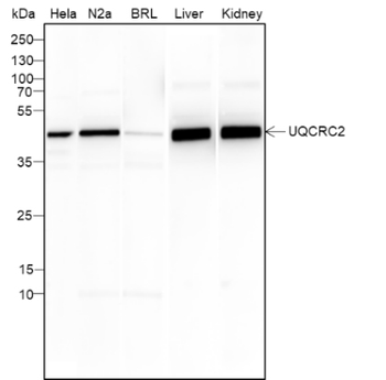 UQCRC2 Recombinant Mouse Monoclonal Antibody
