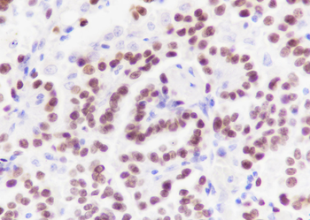 TTF1/NKX2-1 Recombinant Rabbit Monoclonal Antibody