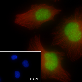 RPA2 Recombinant Rabbit Monoclonal Antibody