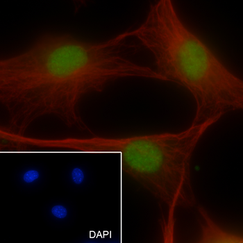 RPA2 Recombinant Rabbit Monoclonal Antibody