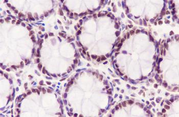 RPA2 Recombinant Rabbit Monoclonal Antibody