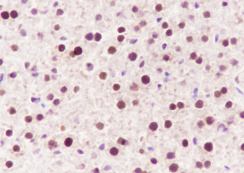 RPA2 Recombinant Rabbit Monoclonal Antibody