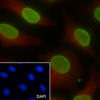 Di-Methyl-Histone H3 (Lys27) Recombinant Mouse Monoclonal Antibody