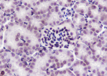 Di-Methyl-Histone H3 (Lys27) Recombinant Mouse Monoclonal Antibody