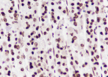 Di-Methyl-Histone H3 (Lys27) Recombinant Mouse Monoclonal Antibody