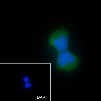 MAP2K4 Recombinant Mouse Monoclonal Antibody