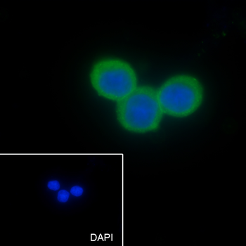 CD66a Recombinant Mouse Monoclonal Antibody