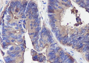 CD66a Recombinant Mouse Monoclonal Antibody