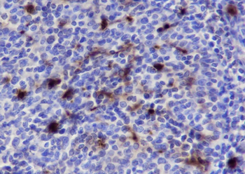 CD66a Recombinant Mouse Monoclonal Antibody