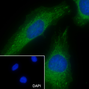 ACADM Recombinant Rabbit Monoclonal Antibody