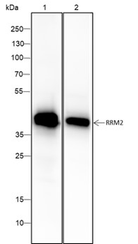 RRM2 Recombinant Mouse Monoclonal Antibody