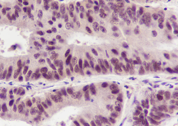 BRD8 Recombinant Mouse Monoclonal Antibody