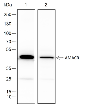 AMACR Recombinant Rabbit Monoclonal Antibody