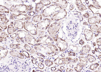 AMACR Recombinant Rabbit Monoclonal Antibody