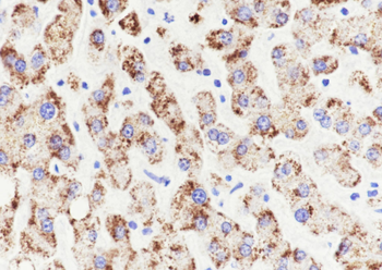 AMACR Recombinant Rabbit Monoclonal Antibody