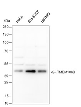 TMEM106B Recombinant Mouse Monoclonal Antibody