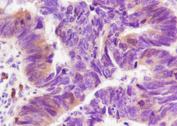 TYMS Recombinant Mouse Monoclonal Antibody